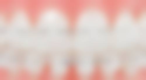 诊疗特色总结:个性化与舒适化并重
● 数字化辅助诊断,精细制定方案
● 注重患者感受,全程舒适管理
张华医生的诊疗特色在于“以人为本”。他充分利用医院配备的数字化X光机、口腔CT等精良设备,实现精细诊断。在治疗过程中,他注重细节,如使用局部麻醉减轻疼痛,治疗后提供详细的护理指导。
