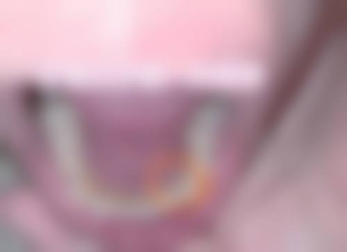 患者真实评价