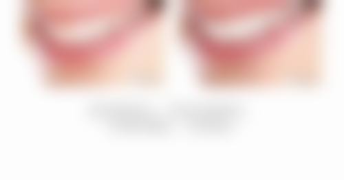 临床实例分享
