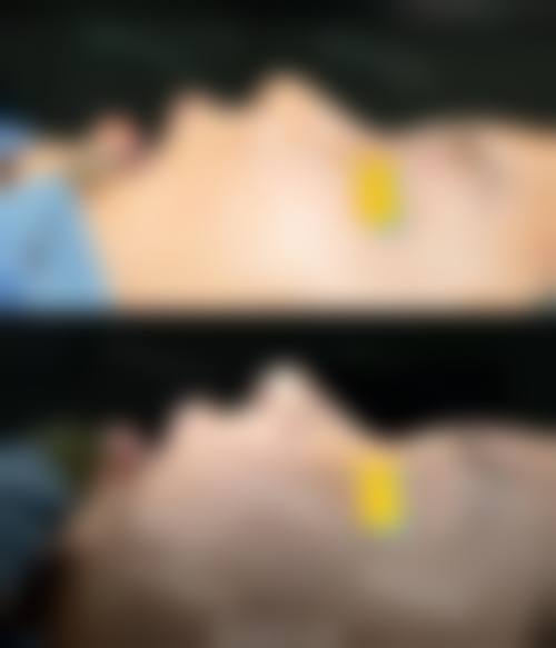 结尾预约号召
