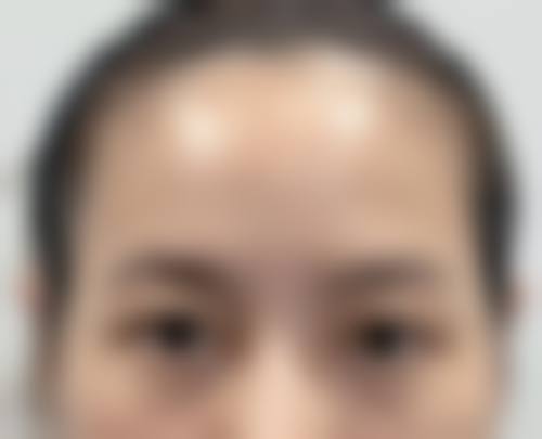 结尾预约号召福州日玥黎医疗美容诊所刘挺