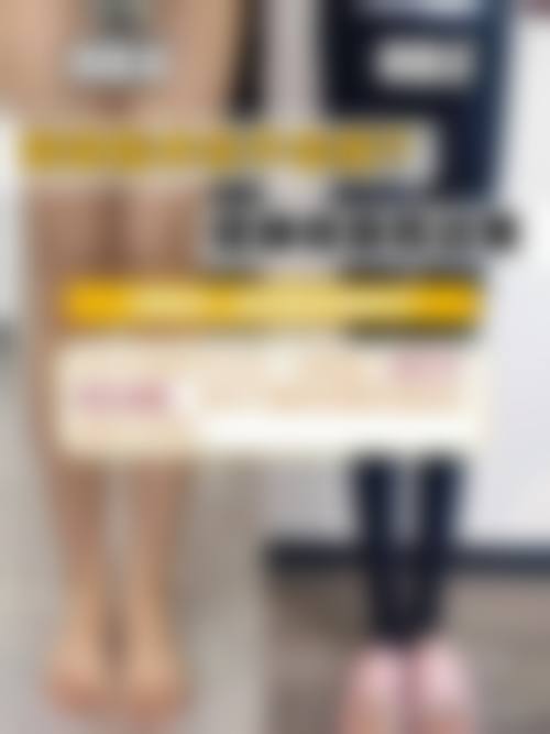 临床实例分享福州日玥黎医疗美容诊所刘挺