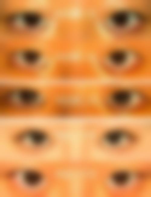 临床实例分享