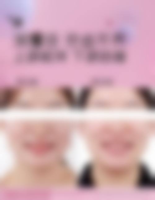 透明价格体系与优惠活动详情