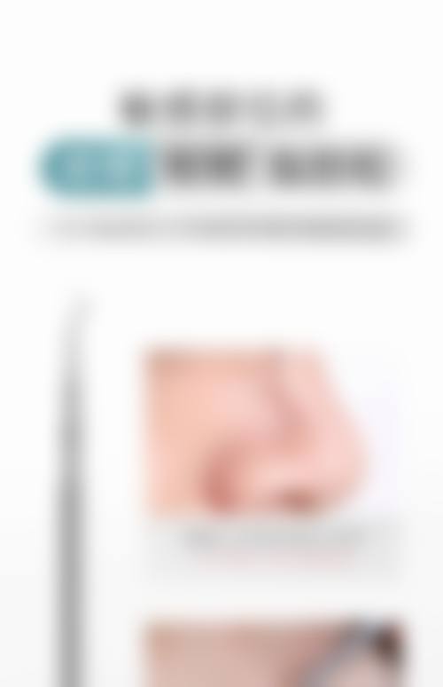 临床实例分享