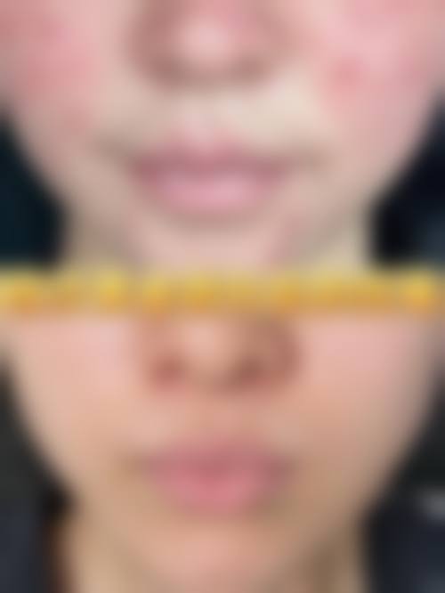 医生资质介绍:曾超医生擅长做我需要的项目吗?