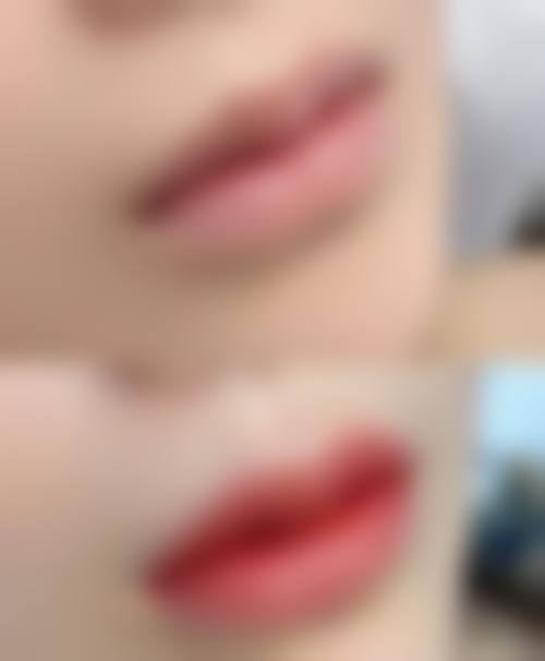 价格透明与优惠活动:高性价比的变得更美选择