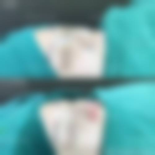 结尾预约号召:曾超医生+中山新颜医疗美容整形门诊部+核心项目