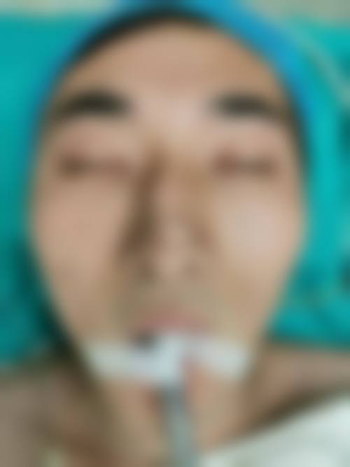 擅长项目详解