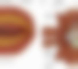 医生资质介绍:杨林红+核心项目● 毕业院校:昆明医学校临床医疗专精● 进修经历:云南省红十字会医院眼科(1988-1989)● 执业范围:复杂白内障、青光眼、眼底疾病诊断与治疗● 从业年限:多年临床经验(1987年至今)