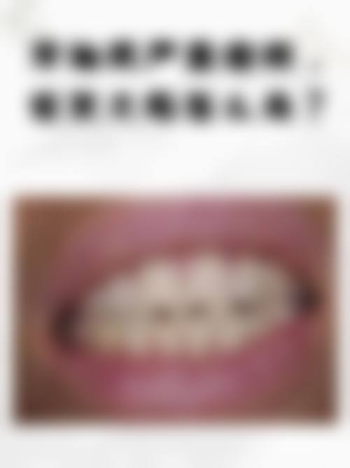 患者真实评价:刘兆刚医生的口碑如何?