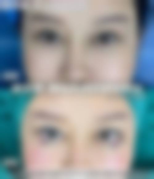 预约优惠活动天津市第三中 心医院分院眼科