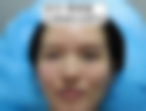 结尾预约号召:杨旭芳+北京美之林医疗美容诊所+核心项目