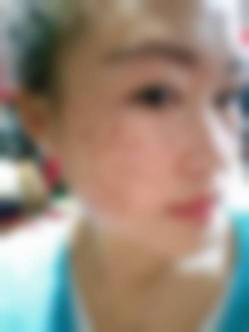 临床实例分享