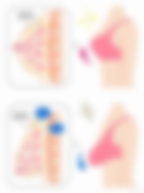 患者真实评价:杨旭芳+北京美之林医疗美容诊所+核心项目