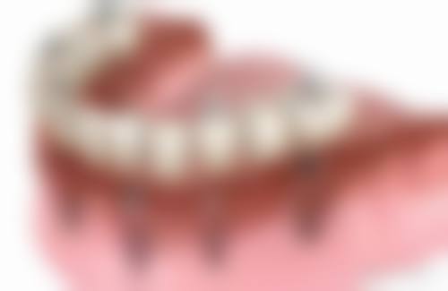 临床实例分享:北京大学口腔医院第五门诊部孙树文的真实反馈