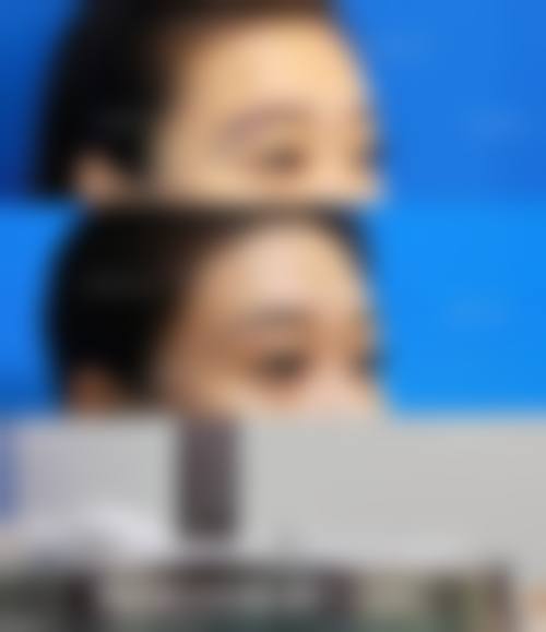 临床实例分享:真实治疗成效见证