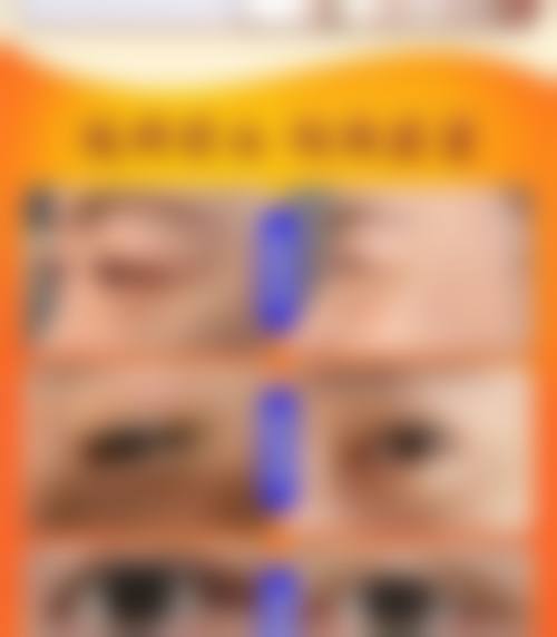 临床实例分享