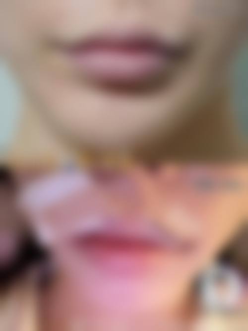 价格透明与优惠活动详情