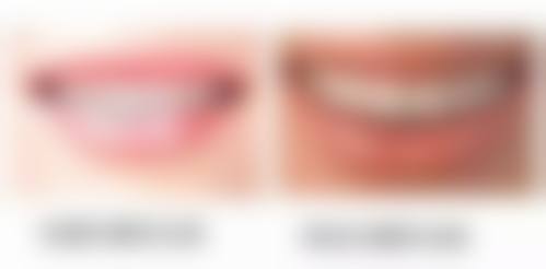 预约优惠活动宁波鄞州诚适口腔门诊部吴燕燕