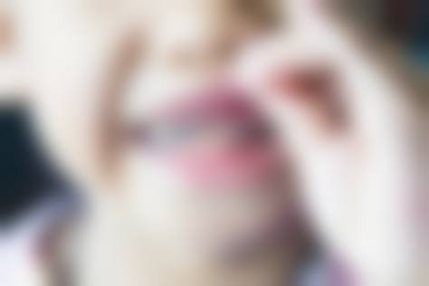 临床实例分享：曾悦医生在南京雅度口腔门诊部的真实反馈