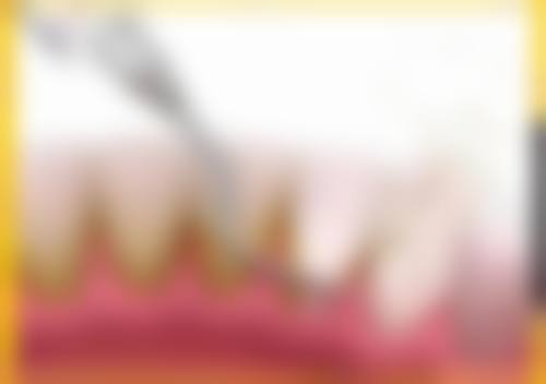 预约优惠活动