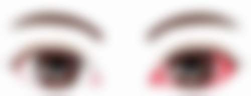 临床实例分享:治疗成效如何?