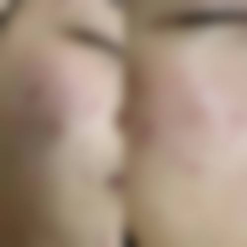 预约优惠活动