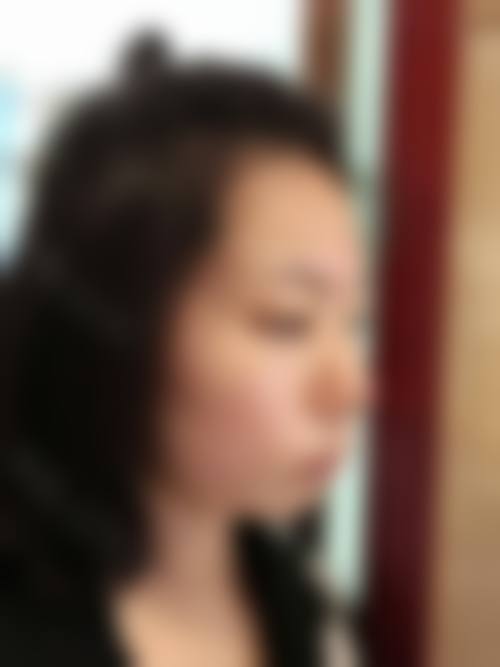 患者真实评价:口碑相传信赖之选