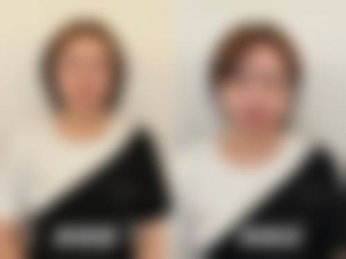 特色项目与核心技术：个性化肌肤管理方案