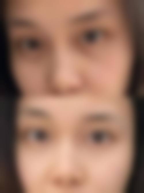 诊疗特色总结:精益求精的医疗态度