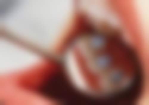 患者真实评价上海悦康口腔门诊部黄胜春