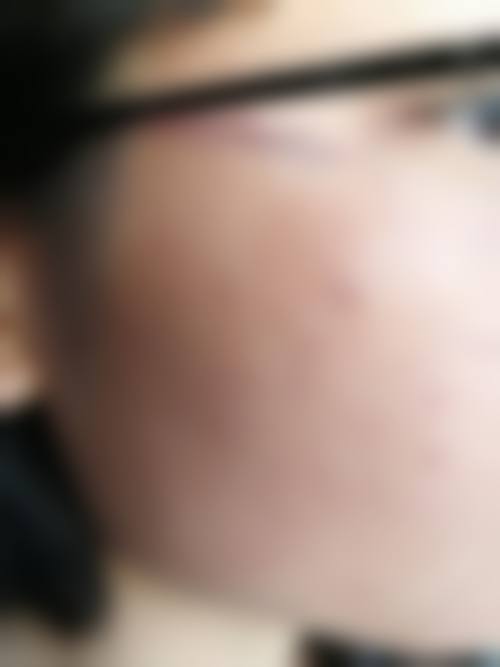 临床实例分享